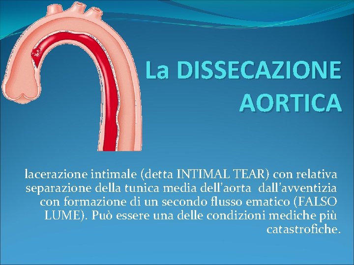 La DISSECAZIONE AORTICA lacerazione intimale (detta INTIMAL TEAR) con relativa separazione della tunica media