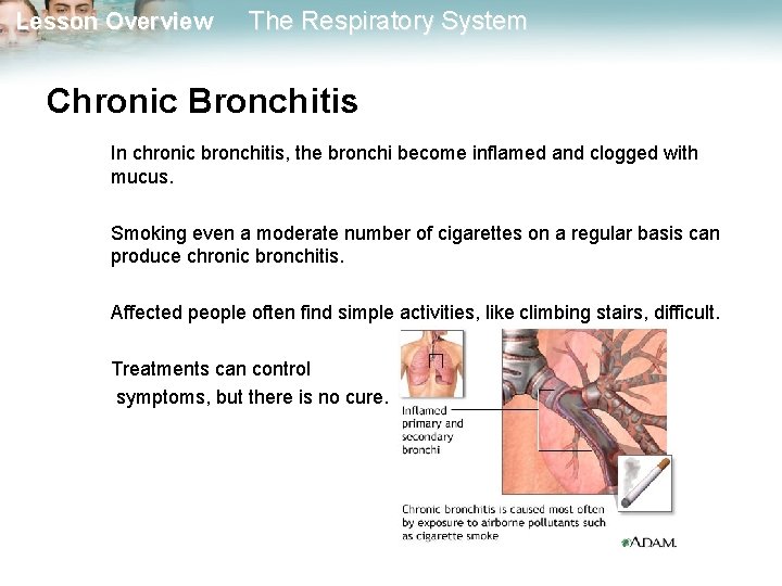 Lesson Overview The Respiratory System Chronic Bronchitis In chronic bronchitis, the bronchi become inflamed