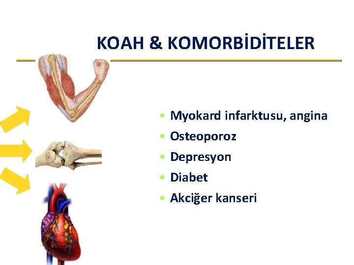 KOAH & KOMORBİDİTELER • Myokard infarktusu, angina • Osteoporoz • Depresyon • Diabet • KOAH & KOMORBİDİTELER • Myokard infarktusu, angina • Osteoporoz • Depresyon • Diabet •