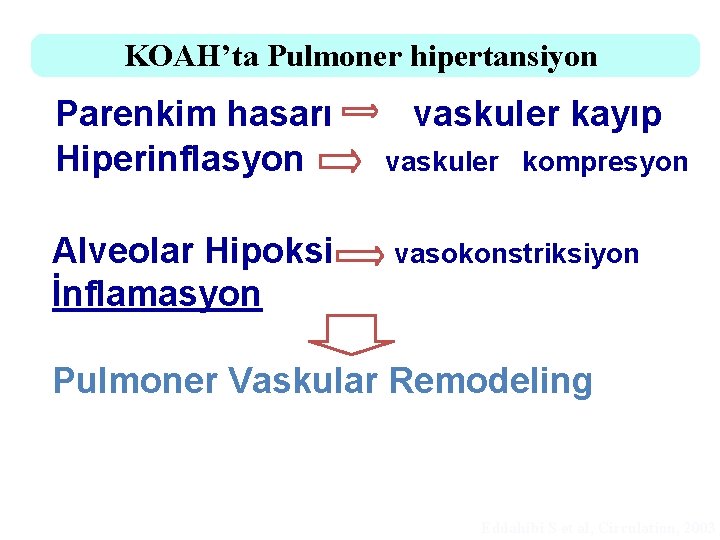 KOAH’ta Pulmoner hipertansiyon Parenkim hasarı Hiperinflasyon Alveolar Hipoksi İnflamasyon vaskuler kayıp vaskuler kompresyon vasokonstriksiyon KOAH’ta Pulmoner hipertansiyon Parenkim hasarı Hiperinflasyon Alveolar Hipoksi İnflamasyon vaskuler kayıp vaskuler kompresyon vasokonstriksiyon