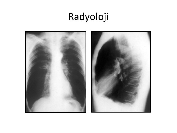 Radyoloji Radyoloji