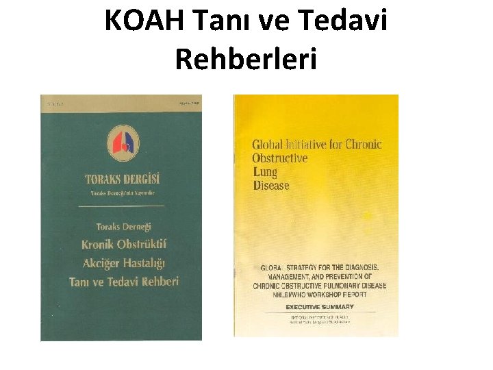 KOAH Tanı ve Tedavi Rehberleri KOAH Tanı ve Tedavi Rehberleri