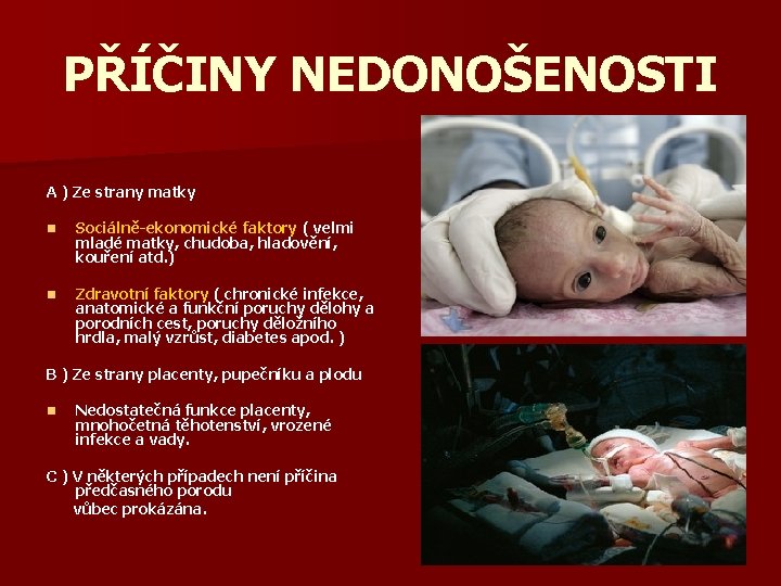 PŘÍČINY NEDONOŠENOSTI A ) Ze strany matky n Sociálně-ekonomické faktory ( velmi mladé matky,
