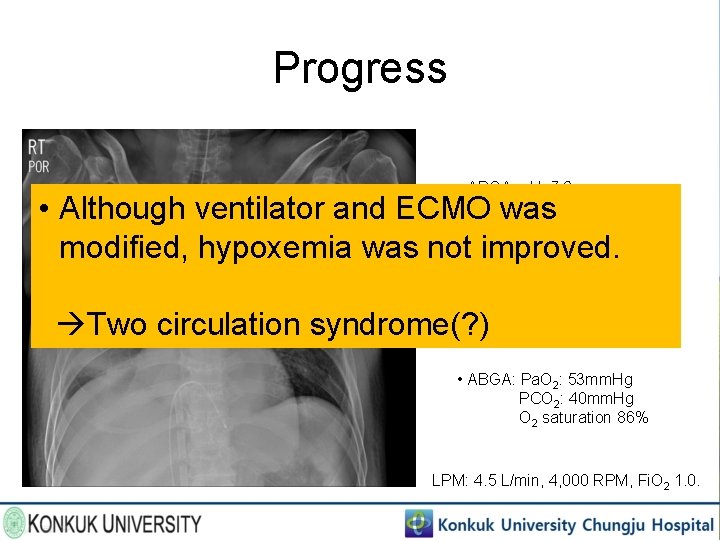 Progress • ABGA: p. H: 7. 2 Pa. O 2: 100 mm. Hg PCO