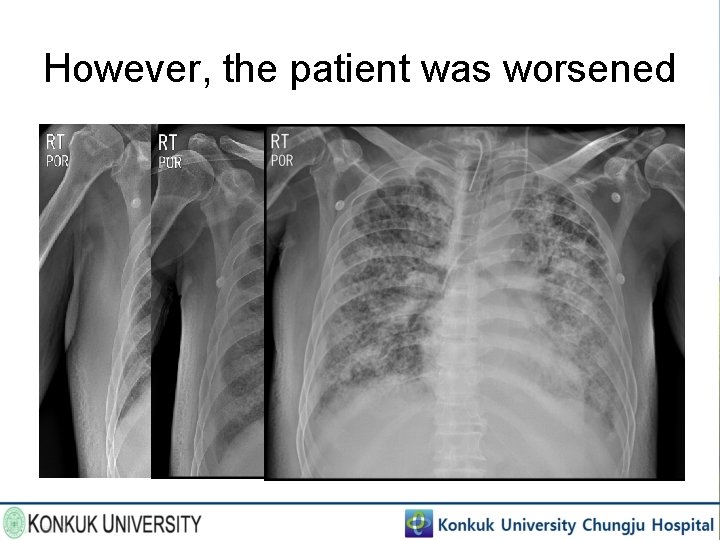 However, the patient was worsened 