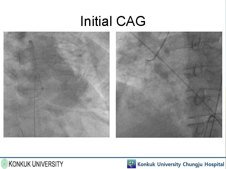 Initial CAG 