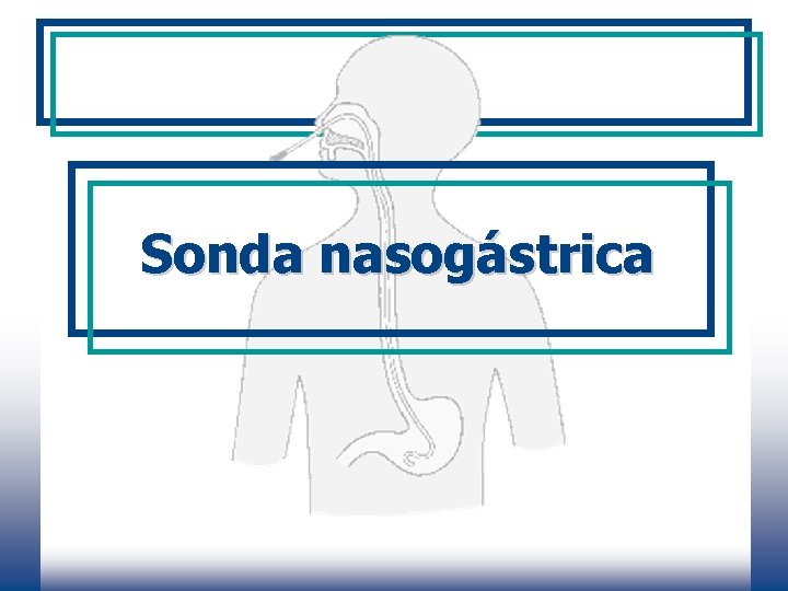 Sonda nasogástrica 