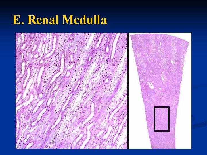 E. Renal Medulla 