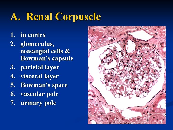 A. Renal Corpuscle 1. in cortex 2. glomerulus, mesangial cells & Bowman's capsule 3.