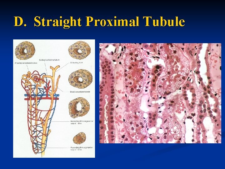 D. Straight Proximal Tubule 