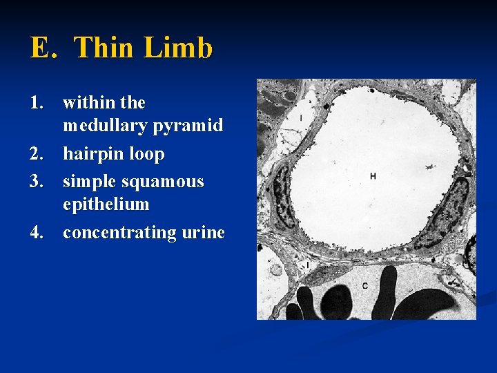 E. Thin Limb 1. within the medullary pyramid 2. hairpin loop 3. simple squamous