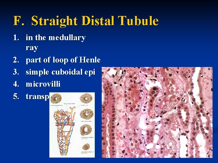 F. Straight Distal Tubule 1. in the medullary ray 2. part of loop of