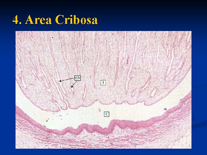 4. Area Cribosa 