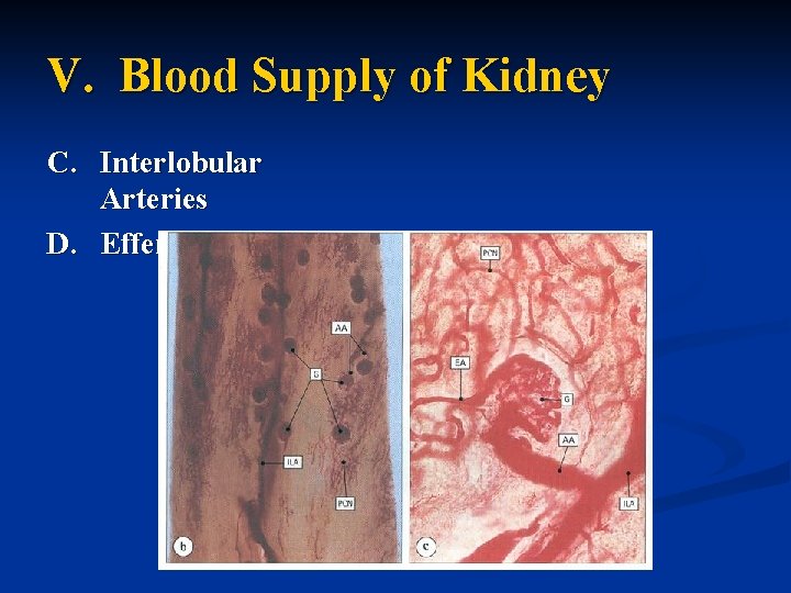 V. Blood Supply of Kidney C. Interlobular Arteries D. Efferent Arterioles 