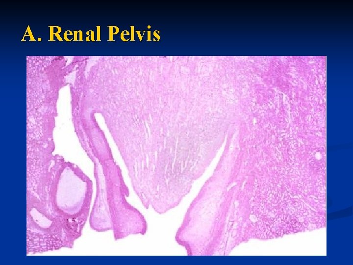 A. Renal Pelvis 