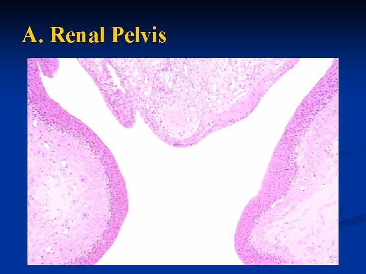 A. Renal Pelvis 