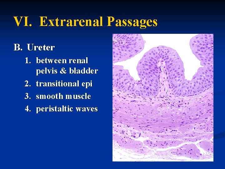 VI. Extrarenal Passages B. Ureter 1. between renal pelvis & bladder 2. transitional epi