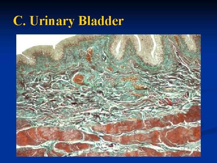 C. Urinary Bladder 