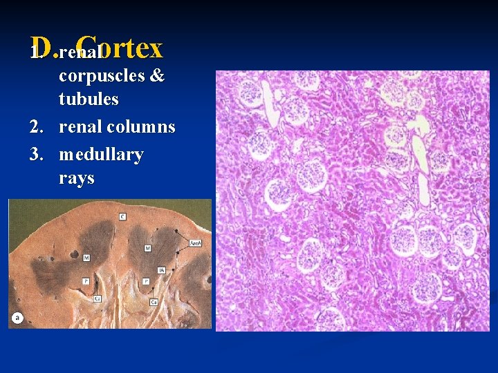 D. renal Cortex 1. corpuscles & tubules 2. renal columns 3. medullary rays 