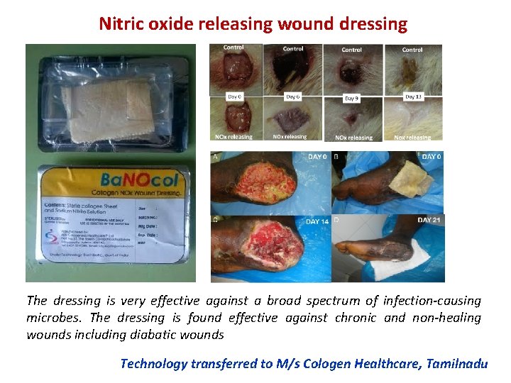 Nitric oxide releasing wound dressing The dressing is very effective against a broad spectrum