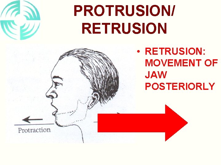 PROTRUSION/ RETRUSION • RETRUSION: MOVEMENT OF JAW POSTERIORLY 