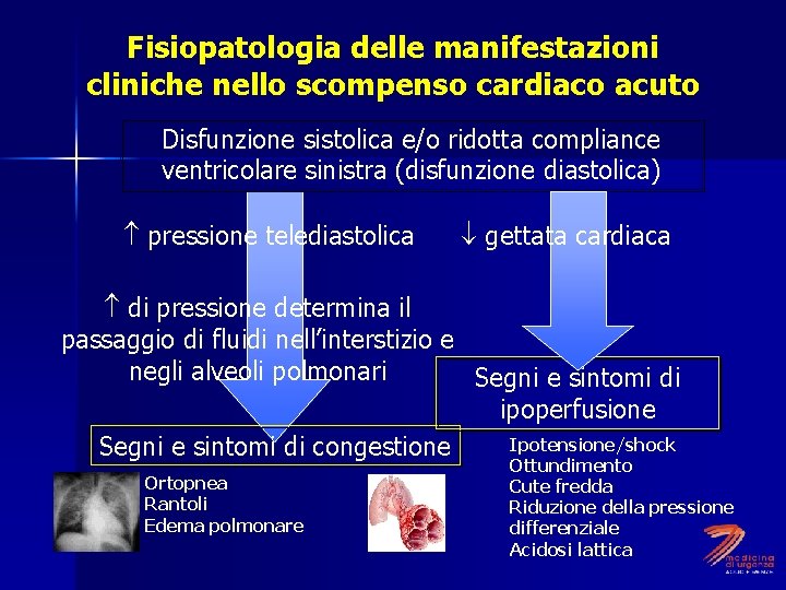 Fisiopatologia delle manifestazioni cliniche nello scompenso cardiaco acuto Disfunzione sistolica e/o ridotta compliance ventricolare