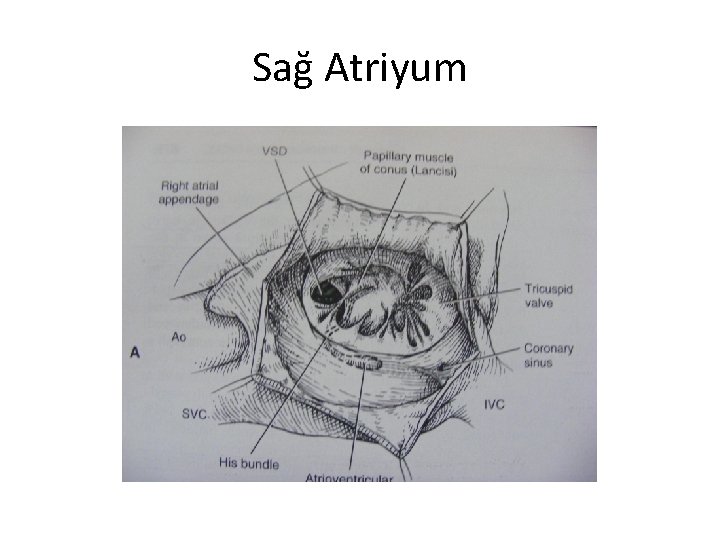 Sağ Atriyum 