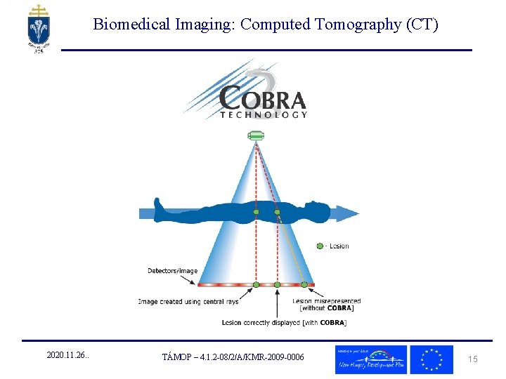 Biomedical Imaging: Computed Tomography (CT) 2020. 11. 26. . TÁMOP – 4. 1. 2 Biomedical Imaging: Computed Tomography (CT) 2020. 11. 26. . TÁMOP – 4. 1. 2