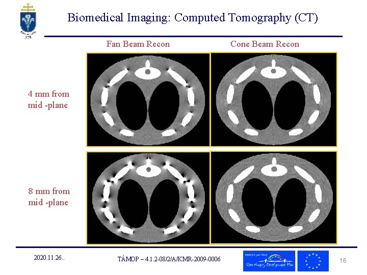 Biomedical Imaging: Computed Tomography (CT) Fan Beam Recon Cone Beam Recon 4 mm from