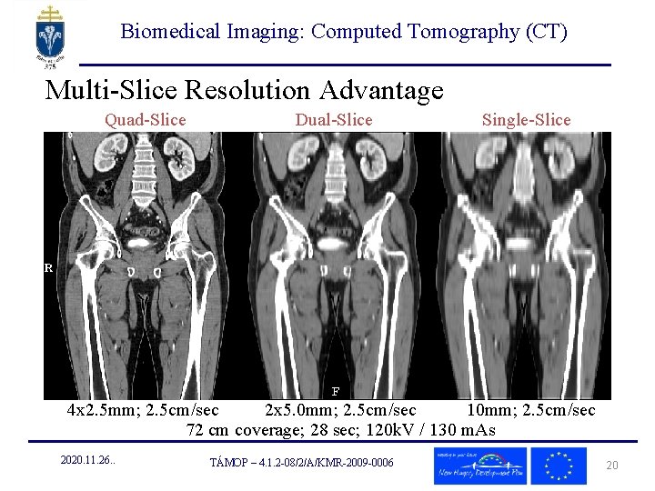 Biomedical Imaging: Computed Tomography (CT) Multi-Slice Resolution Advantage Quad-Slice Dual-Slice Single-Slice 4 x 2.