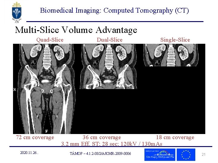 Biomedical Imaging: Computed Tomography (CT) Multi-Slice Volume Advantage Quad-Slice Dual-Slice Single-Slice 72 cm coverage