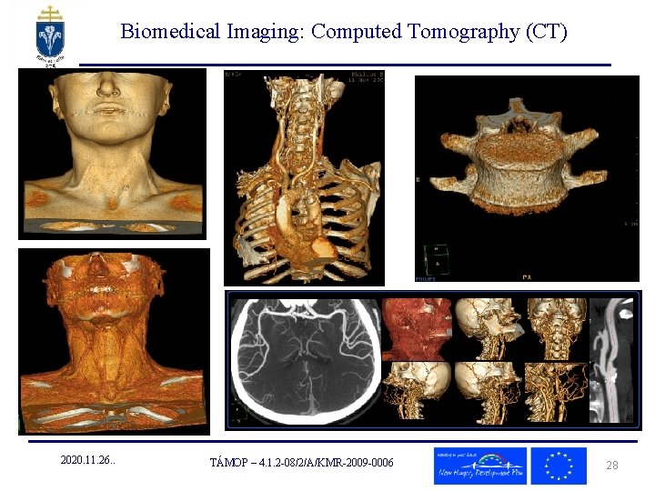 Biomedical Imaging: Computed Tomography (CT) 2020. 11. 26. . TÁMOP – 4. 1. 2