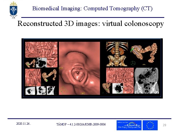 Biomedical Imaging: Computed Tomography (CT) Reconstructed 3 D images: virtual colonoscopy 2020. 11. 26.