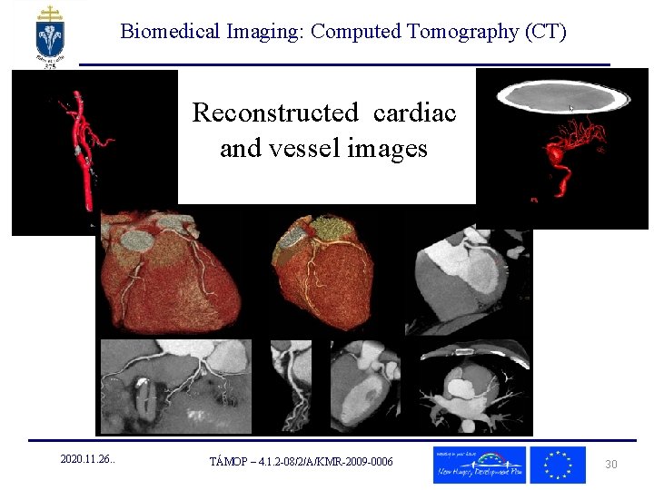 Biomedical Imaging: Computed Tomography (CT) Reconstructed cardiac and vessel images 2020. 11. 26. .