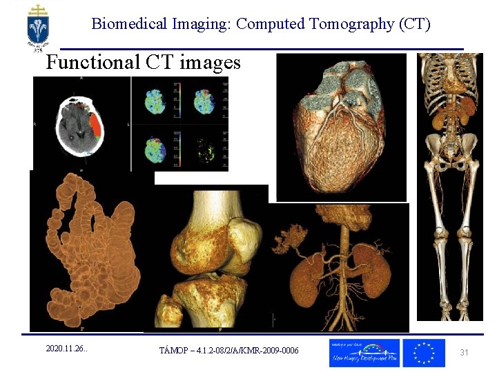 Biomedical Imaging: Computed Tomography (CT) Functional CT images 2020. 11. 26. . TÁMOP –