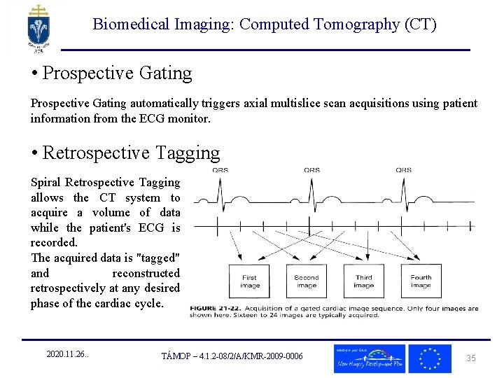 Biomedical Imaging: Computed Tomography (CT) • Prospective Gating automatically triggers axial multislice scan acquisitions