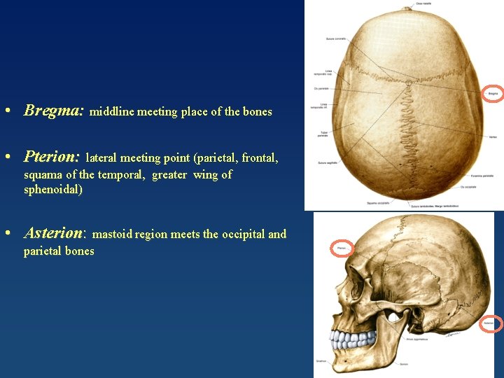  • Bregma: middline meeting place of the bones • Pterion: lateral meeting point