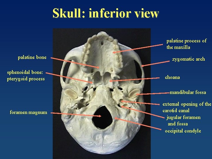 Skull: inferior view palatine process of the maxilla palatine bone sphenoidal bone: pterygoid process