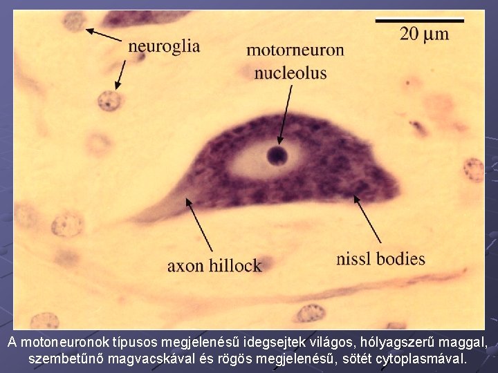 A motoneuronok típusos megjelenésű idegsejtek világos, hólyagszerű maggal, szembetűnő magvacskával és rögös megjelenésű, sötét