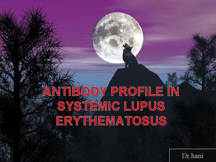 ANTIBODY PROFILE IN SYSTEMIC LUPUS ERYTHEMATOSUS Dr. hani 