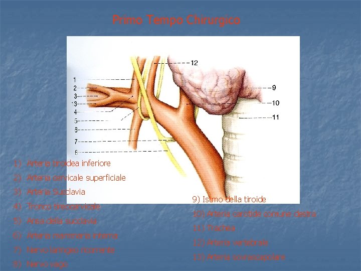 Primo Tempo Chirurgico 1) Arteria tiroidea inferiore 2) Arteria cervicale superficiale 3) Arteria Succlavia