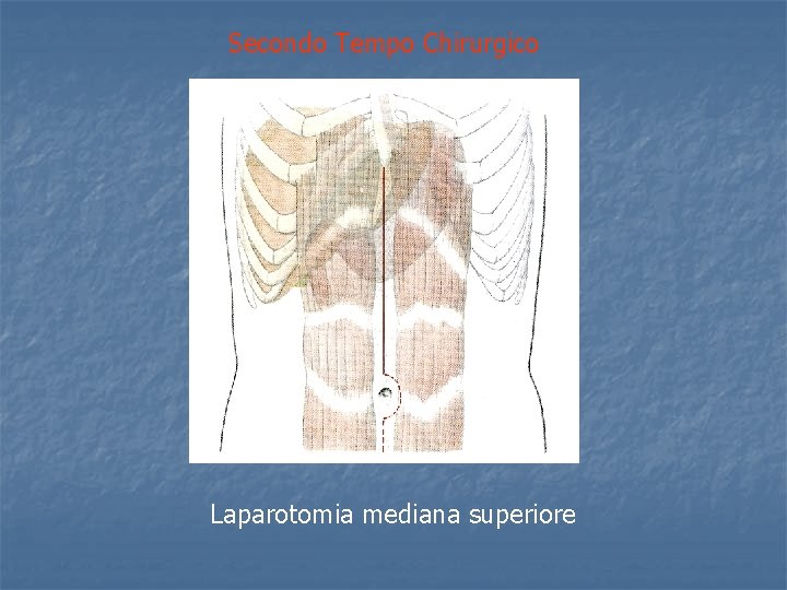 Secondo Tempo Chirurgico Laparotomia mediana superiore 