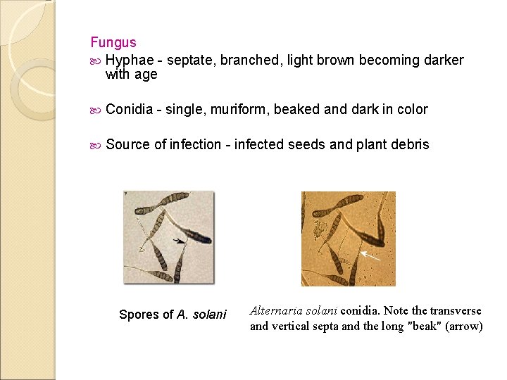 Fungus Hyphae - septate, branched, light brown becoming darker with age Conidia - single,