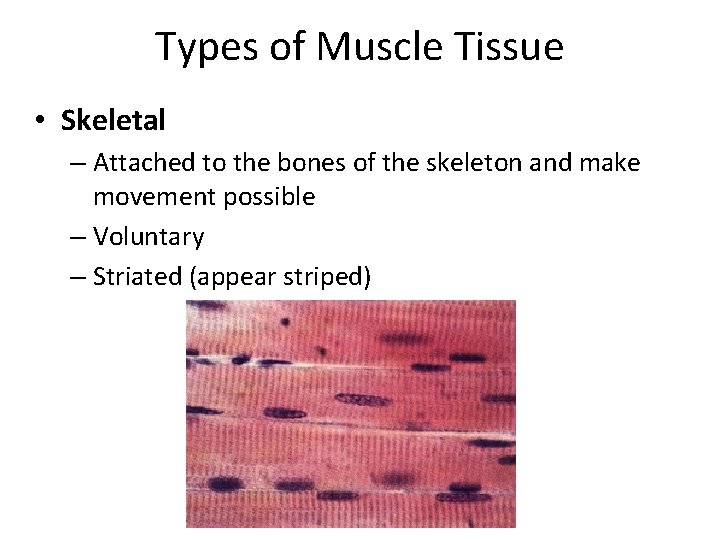 Types of Muscle Tissue • Skeletal – Attached to the bones of the skeleton