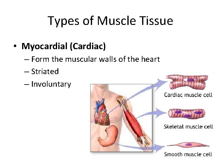 Types of Muscle Tissue • Myocardial (Cardiac) – Form the muscular walls of the