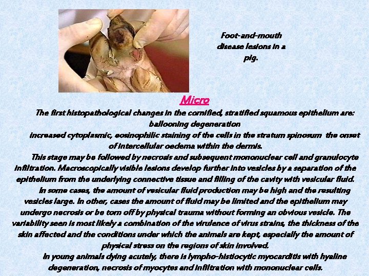 Foot-and-mouth disease lesions in a pig. Micro The first histopathological changes in the cornified,