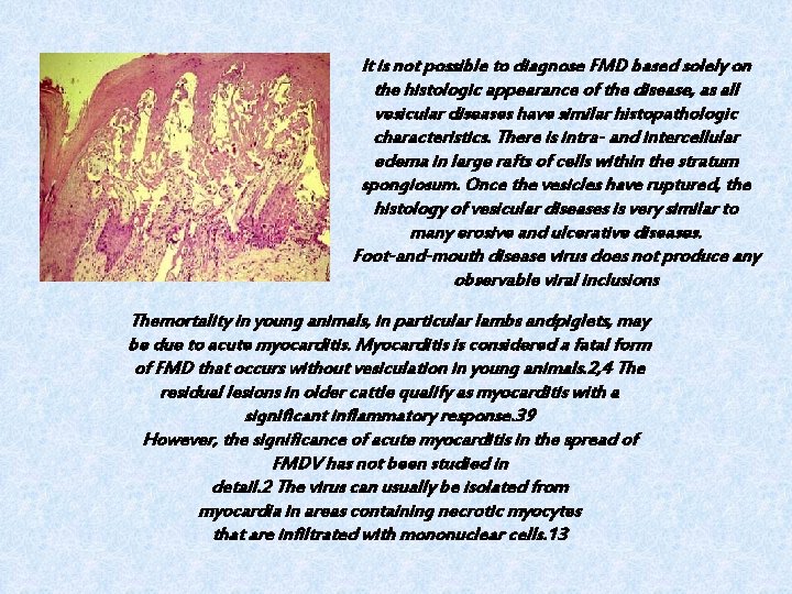 It is not possible to diagnose FMD based solely on the histologic appearance of