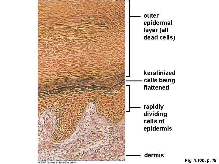 outer epidermal layer (all dead cells) keratinized cells being flattened rapidly dividing cells of