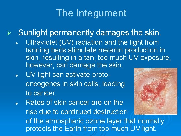 The Integument Sunlight permanently damages the skin. Ø l l l Ultraviolet (UV) radiation