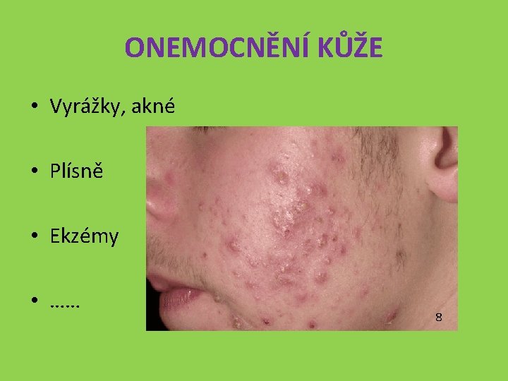 ONEMOCNĚNÍ KŮŽE • Vyrážky, akné • Plísně • Ekzémy • …… 8 